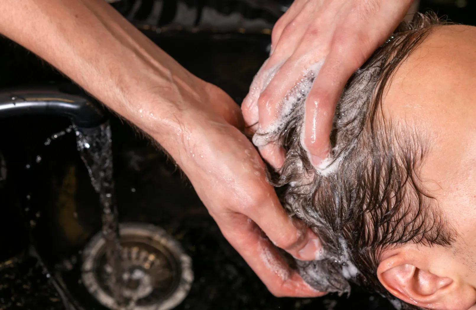 Scalp Scaling & Detox