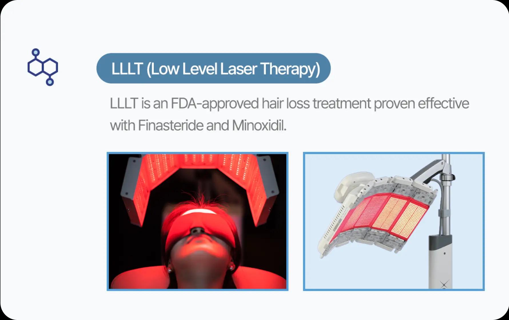 홀드 탈모치료 프로그램 4