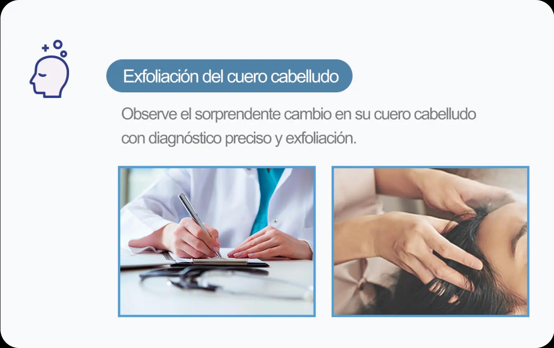 홀드 탈모치료 프로그램 2