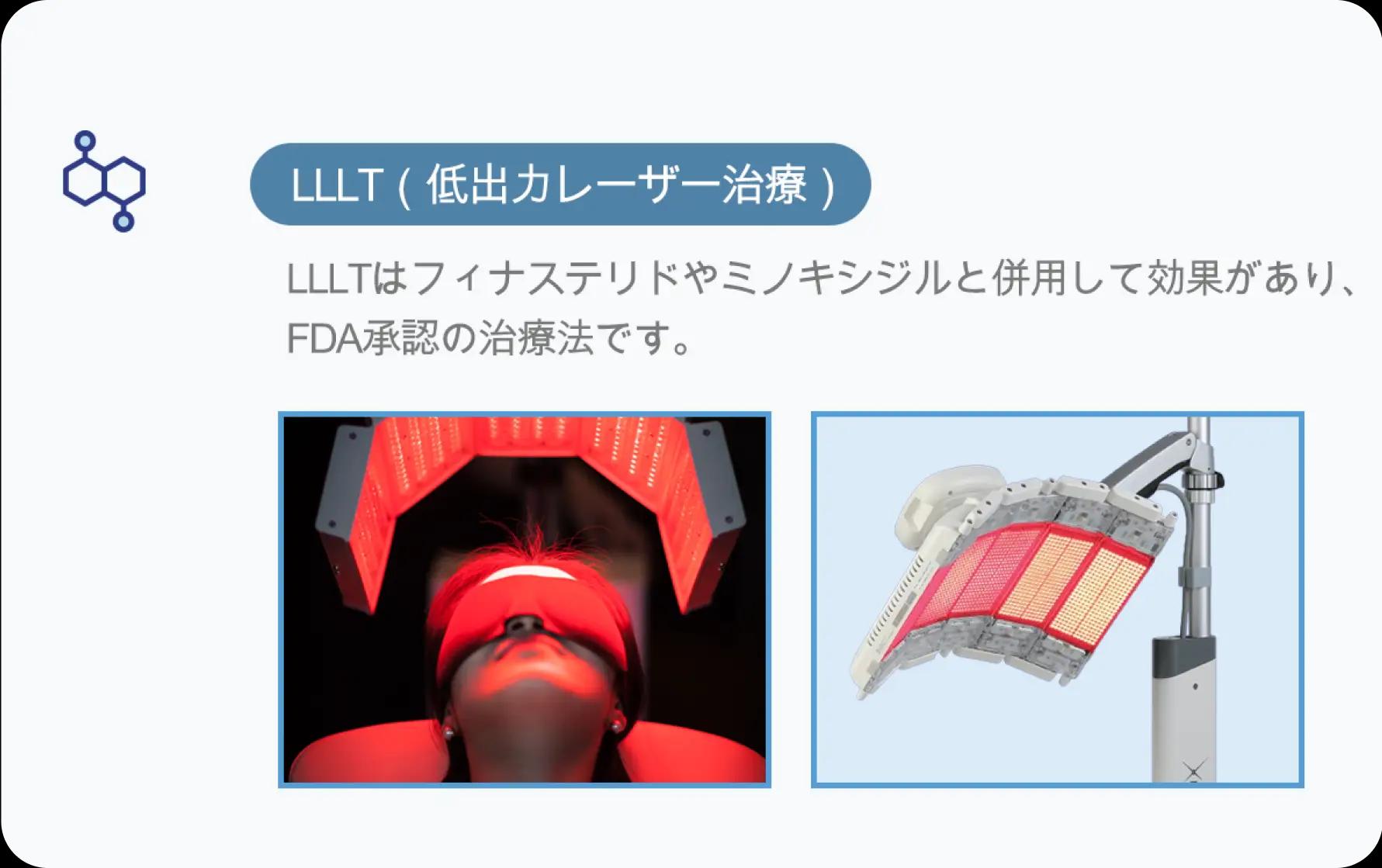 홀드 탈모치료 프로그램 4
