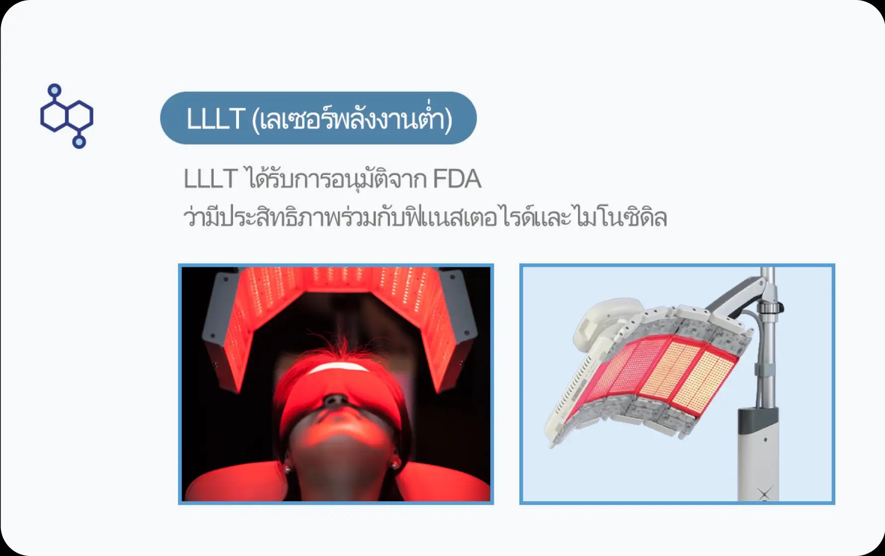 홀드 탈모치료 프로그램 4