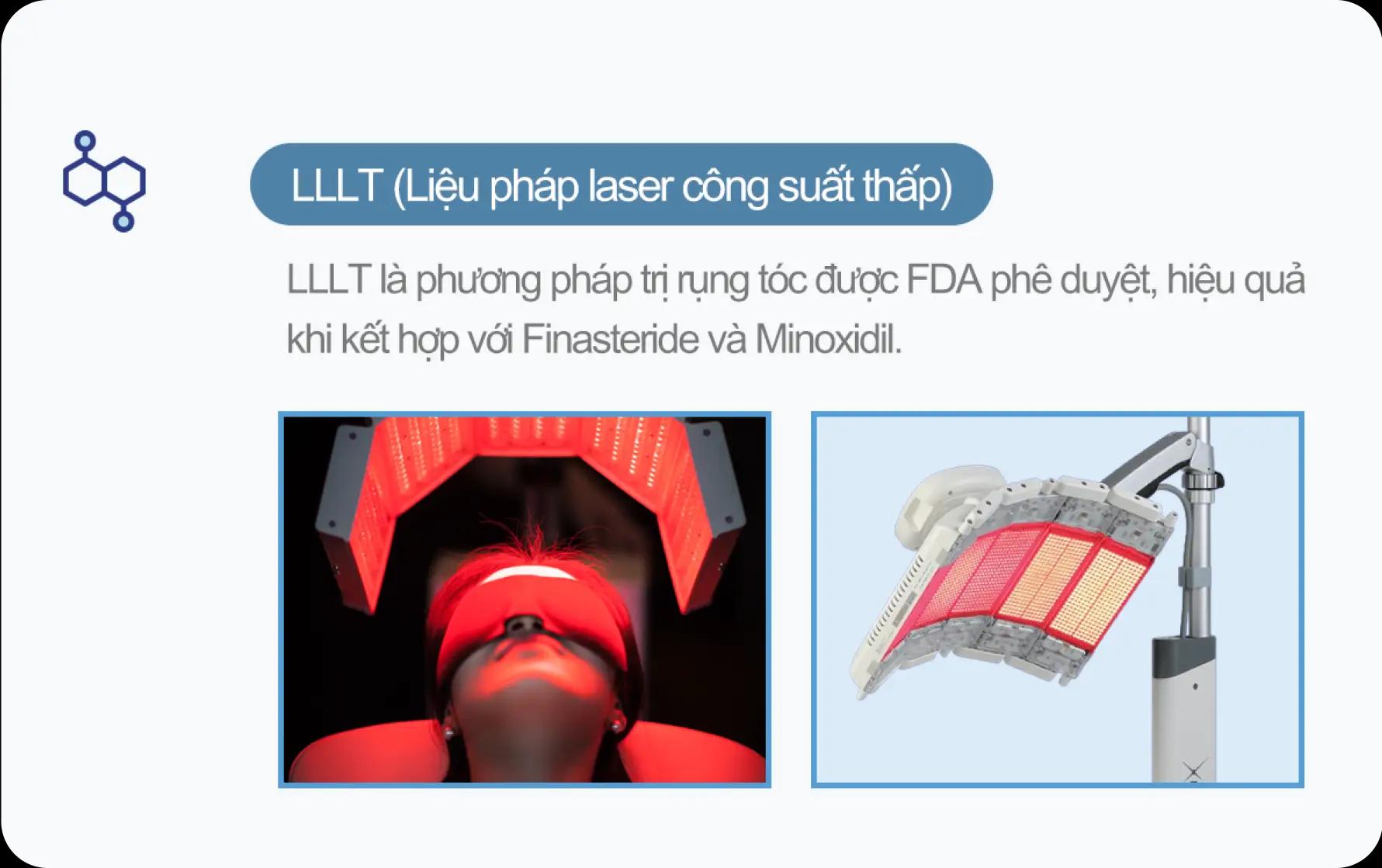 홀드 탈모치료 프로그램 4