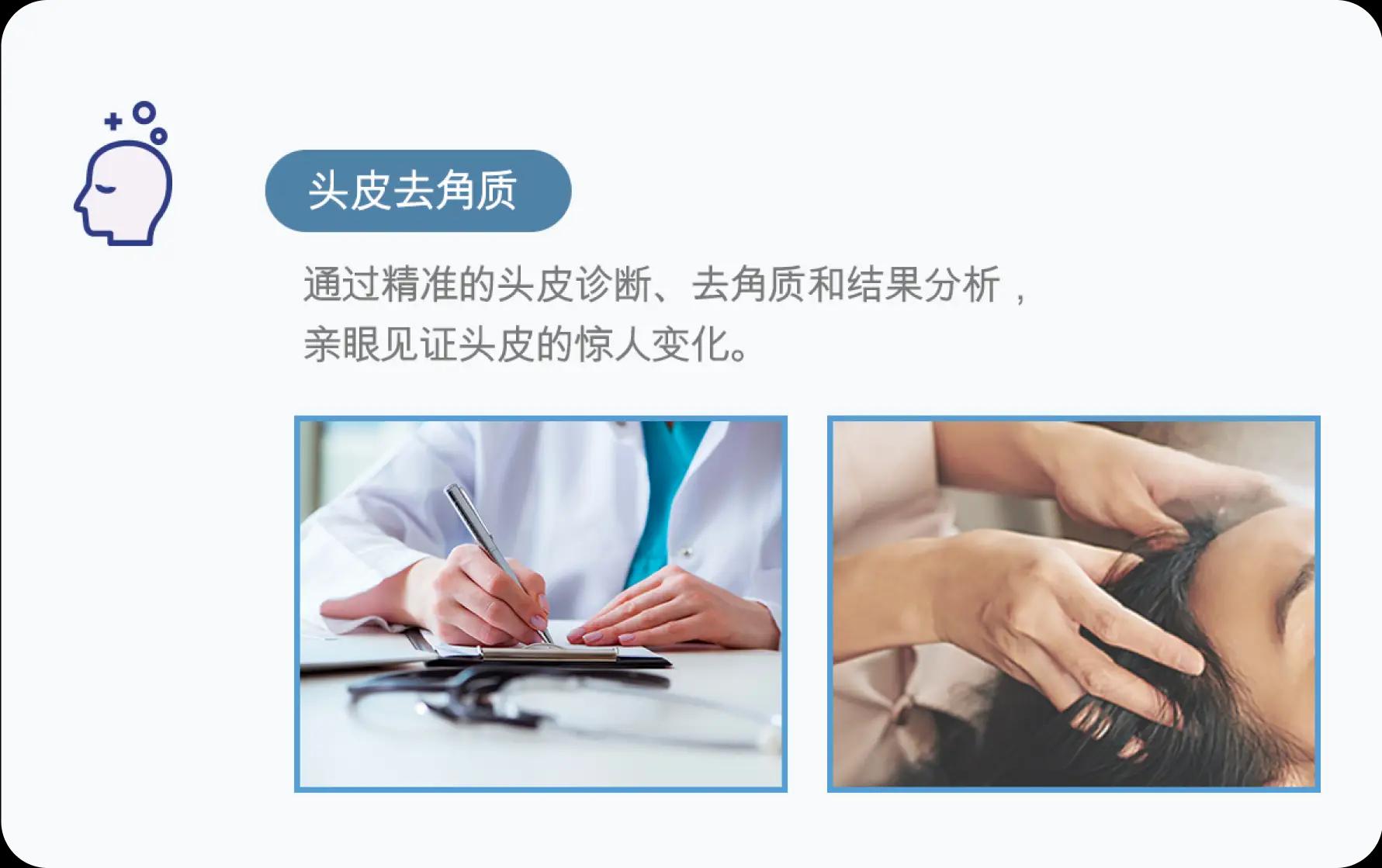 홀드 탈모치료 프로그램 2