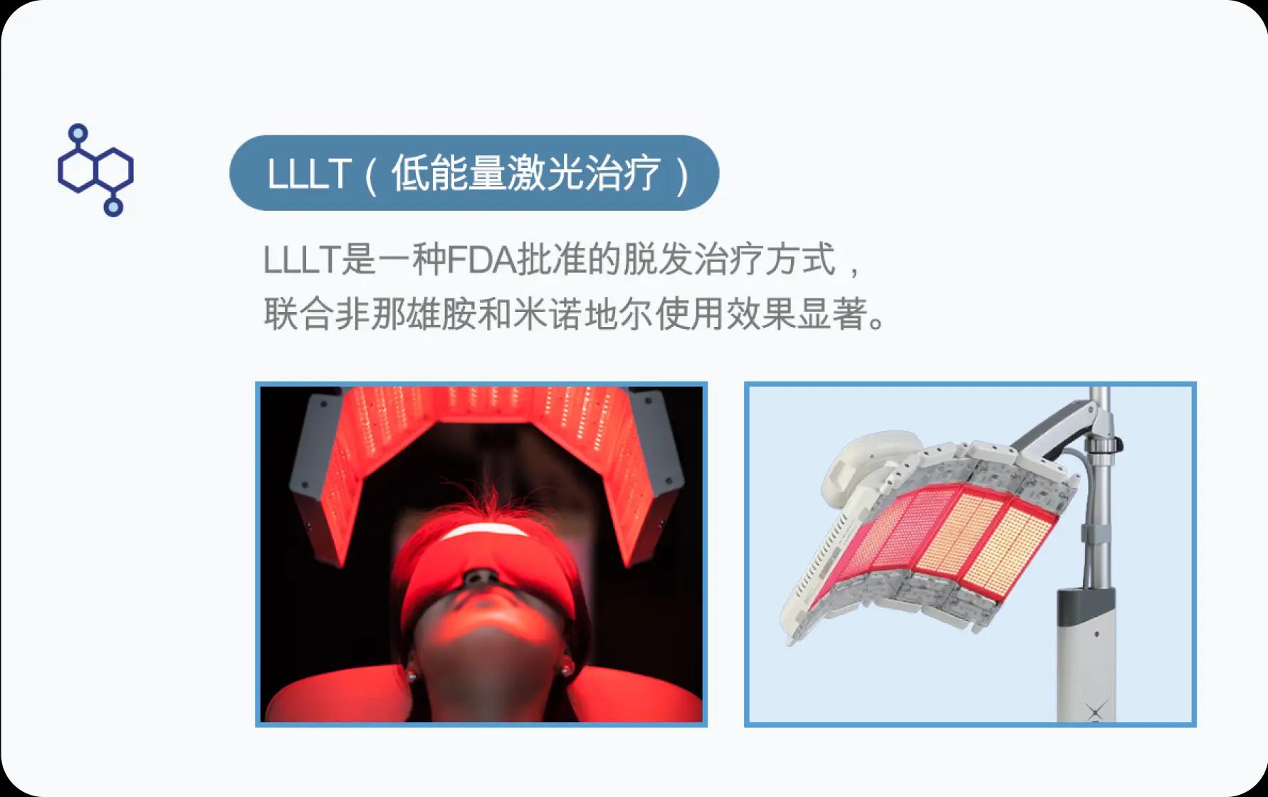 홀드 탈모치료 프로그램 4