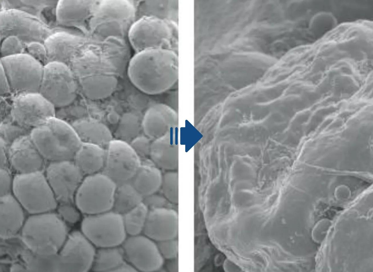 ลดจำนวน ไม่ใช่แค่ขนาดของเซลล์ไขมัน