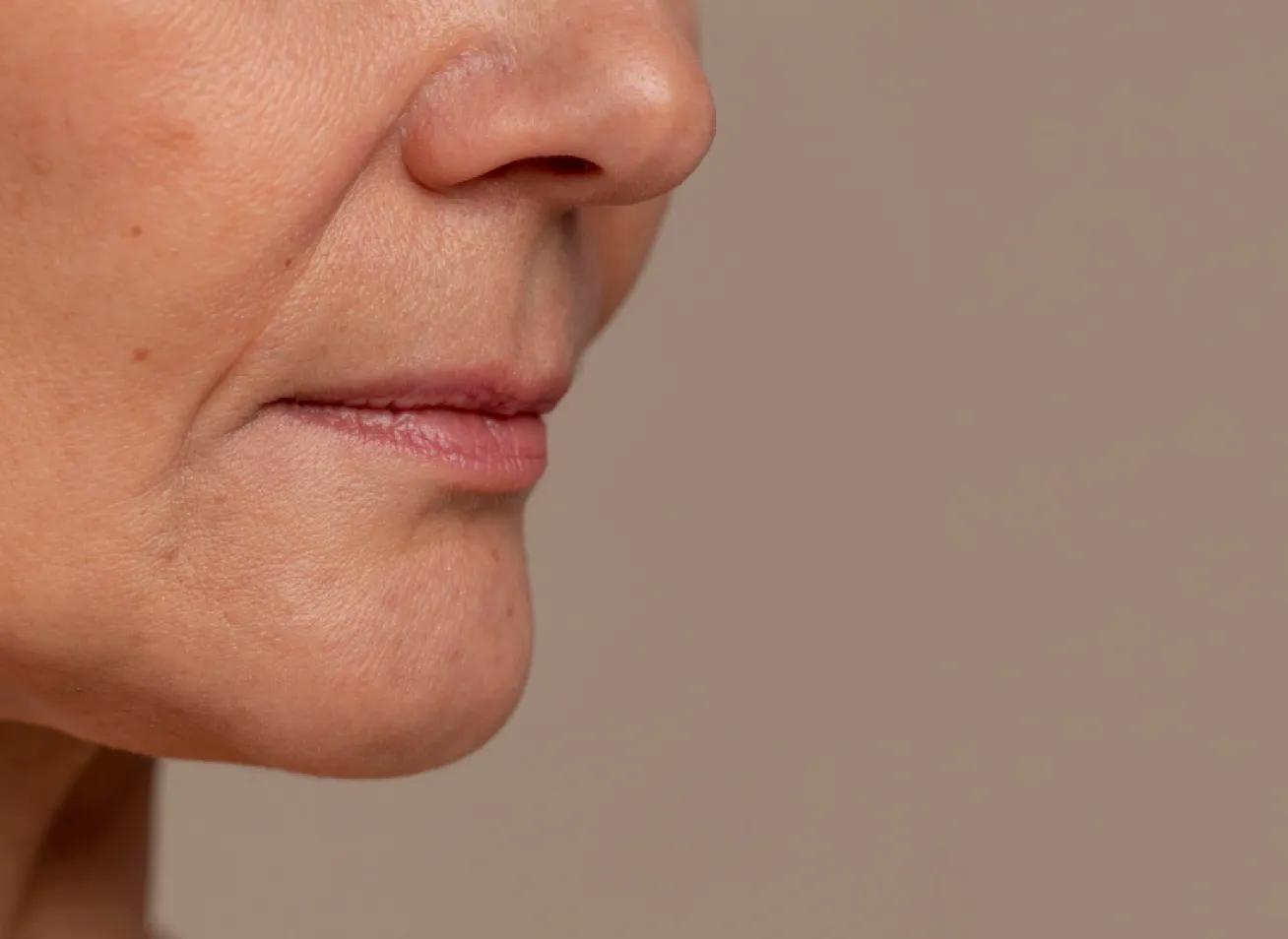 Làm mờ nếp nhăn biểu cảm thần kỳ