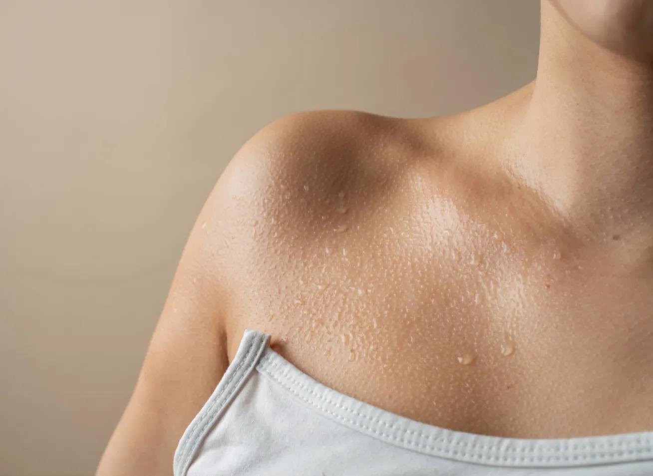 Cải thiện tiết mồ hôi & đàn hồi da (Dermotoxin)