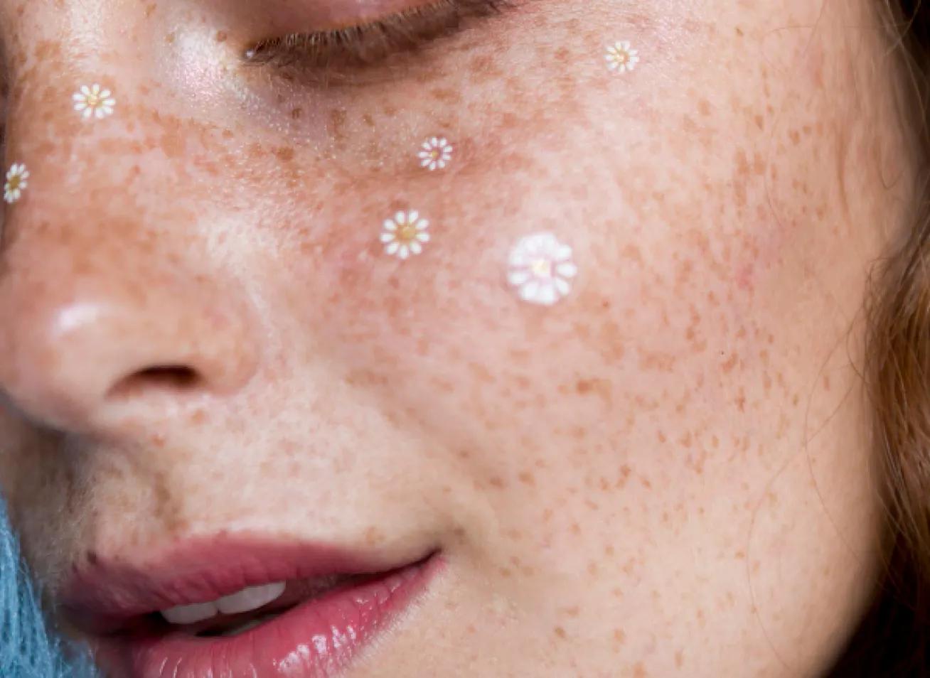 A Solution for Stubborn Pigmentation and Tattoo Removal