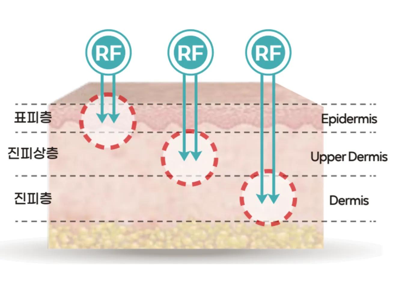 Cải thiện tận gốc môi trường da